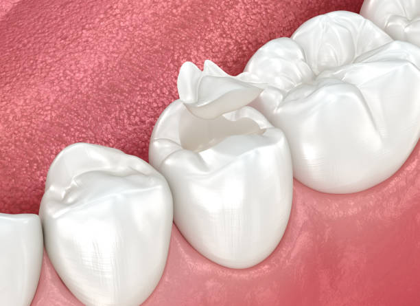 Oral Surgery in Rutledge, GA